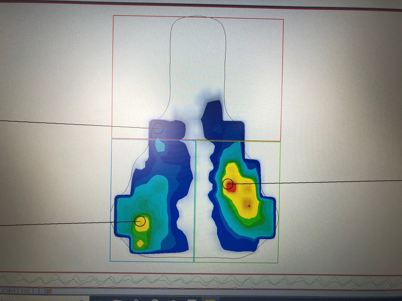 Satteldruckmessung Bikefitting München
